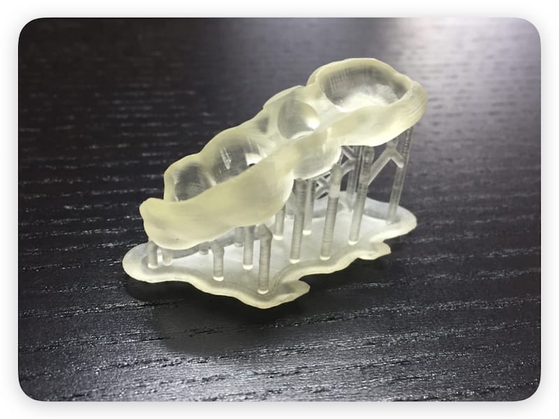 Zahnarzt Bohrschabblone 3D-Druck rioprinto Draufsicht