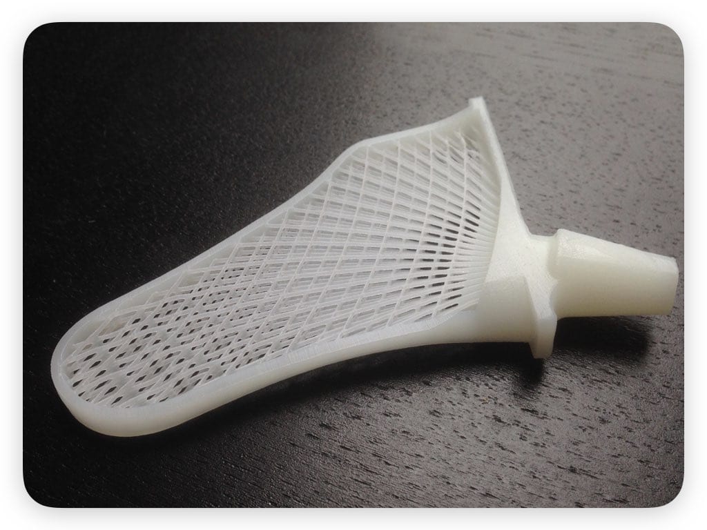 Hüftgelenk aus dem 3D-Drucker - Medizin
